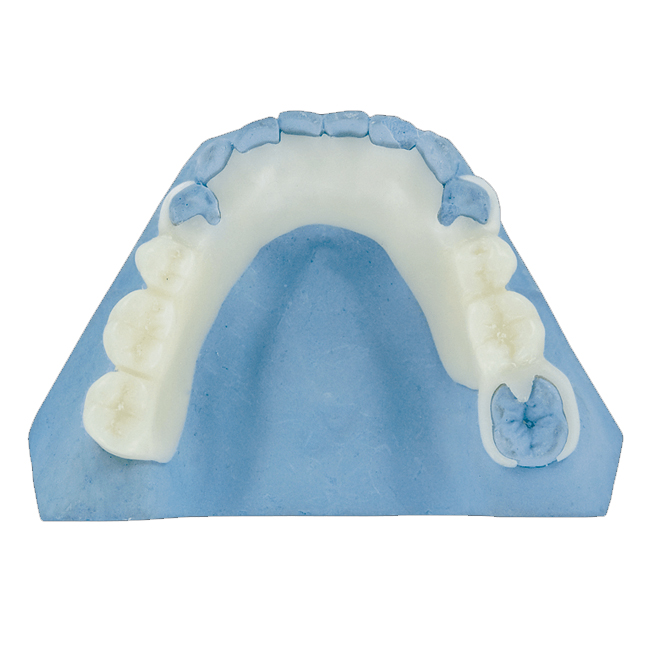Система моста 3D цифров OEM PFM зубоврачебная Intraoral просматривая отображая