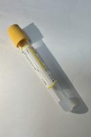 Blood Test Tube Infectious Disease Screening Smart Separation Technology Rapid Clotting Acceleration