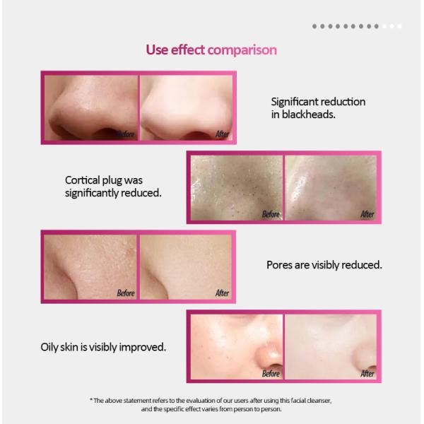 Facial Brush for Silicone Brush Deep Pore Cleansing Target Area Face Net Weight 306g