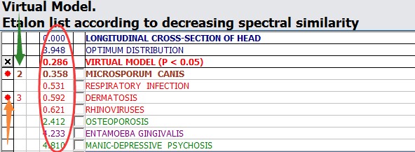 Hunter metatron machine 4025 SSCH NLS Health Diagnostic Metapathia 18D NLS
