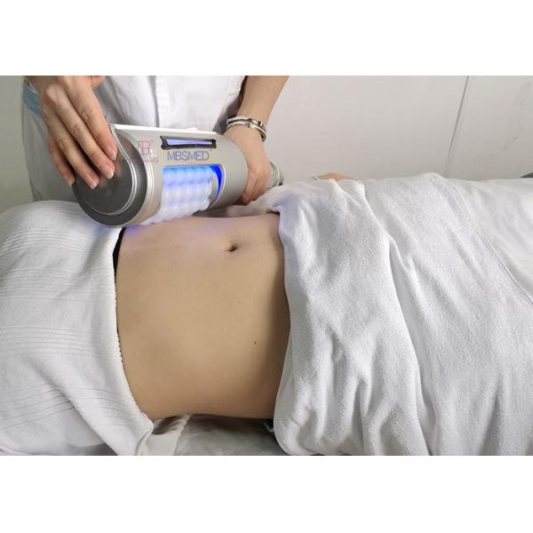 Вакуум Starvac Sp2 уменьшая удаление отека машины ролика шарика массажа внутреннее