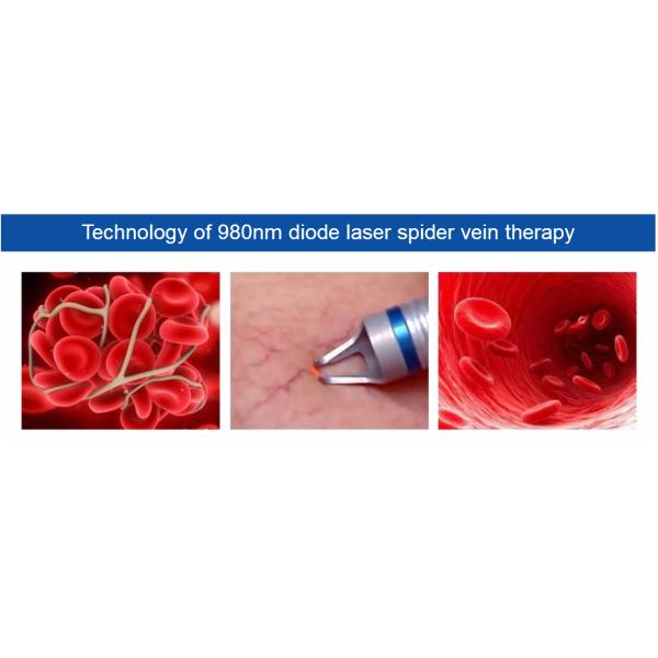 Портативная машина подмолаживания кожи для удаления кровеносных сосудов васкулярной терапией красного