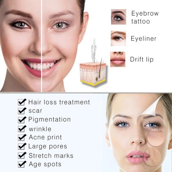 Derma Pen Needles 1/3/5/7/9/12/36/42 Pins/Nano Needle Cartridge for Derma Rolling System