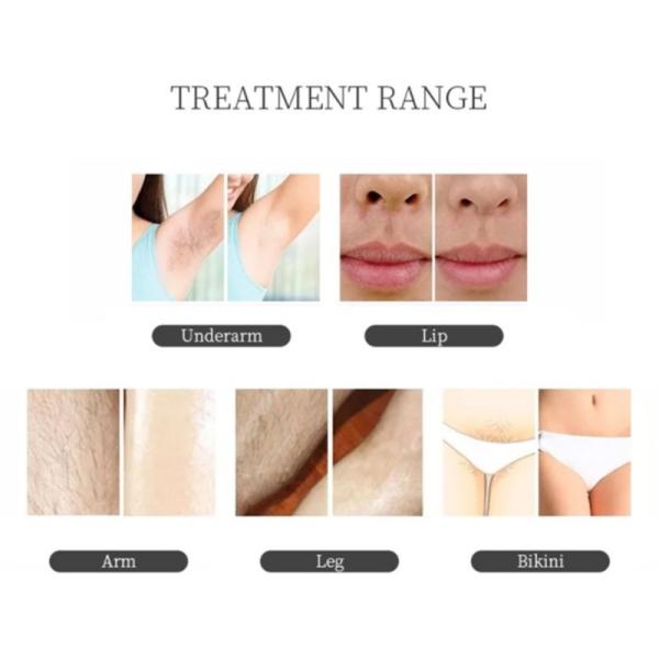 Effective 2in1 808 Diode Laser Hair Removal Nd Yag Tattoo Removal For Home