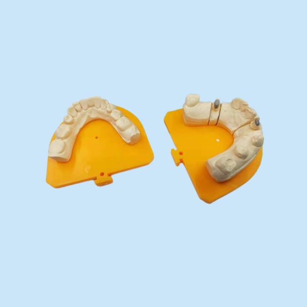 High Strength Yellow Gold Porcelain Dental Crown PFM Ceramic Crown