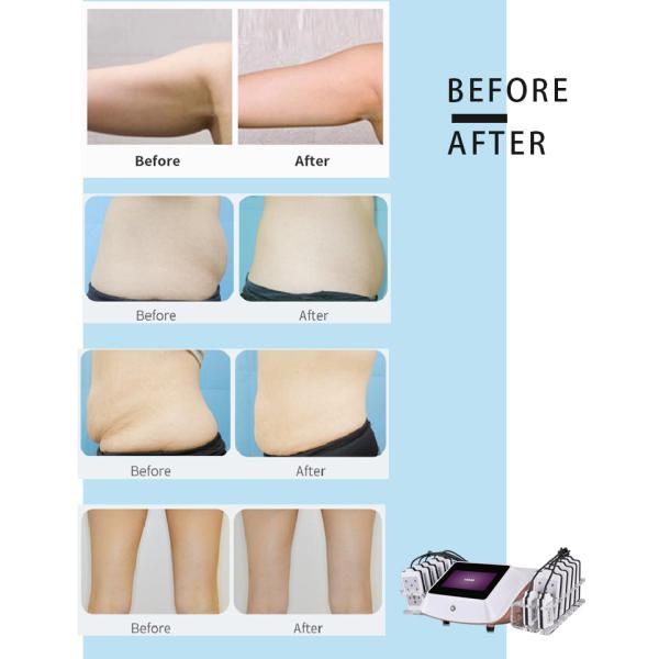 Best Sale Lipo Laser 14 Pads LED lipolaser slimming beauty machine / fat burning laser LF-129c