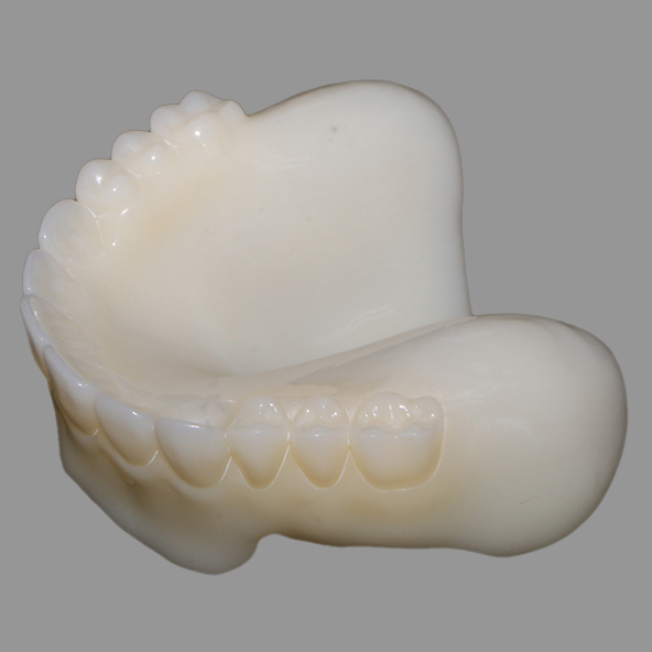 Prueba de prótesis dentaria impresa en 3D en A1/A2/A3 biocompatible para un ajuste perfecto y una oclusión