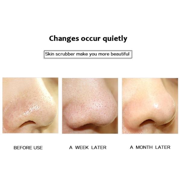 Ultrasonic Waves Skin Care Machine