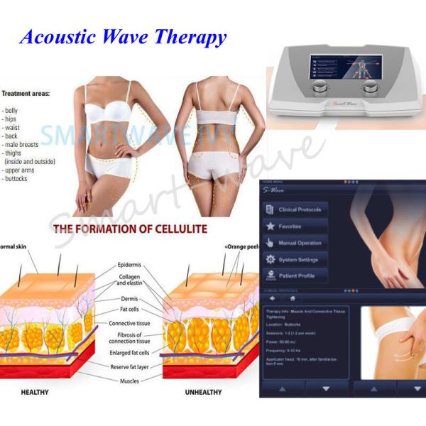 Терапия акустической волны красоты для источника Ген целлюлита 4рд магнитного электрического