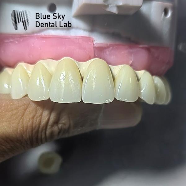 Regular Implanted Device Cases Steam Sterilization Implant Cases