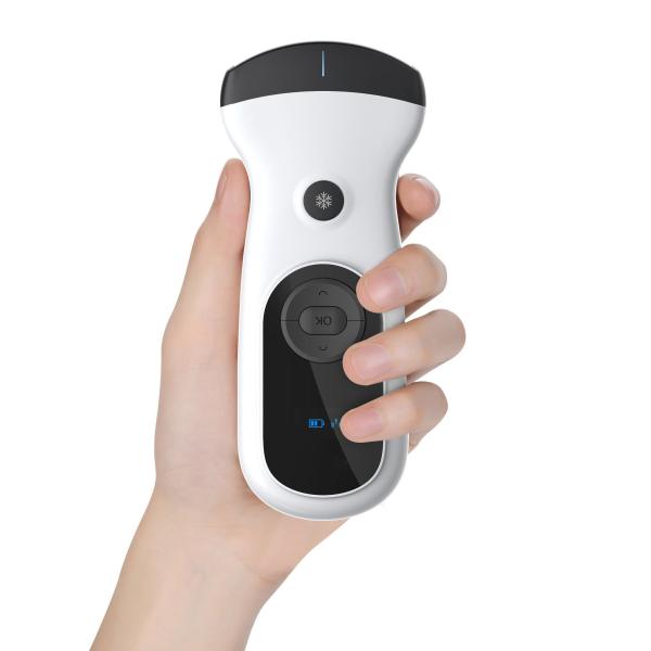 2025 Best Handheld Ultrasound | NMPA Approved with HD Frame Rate