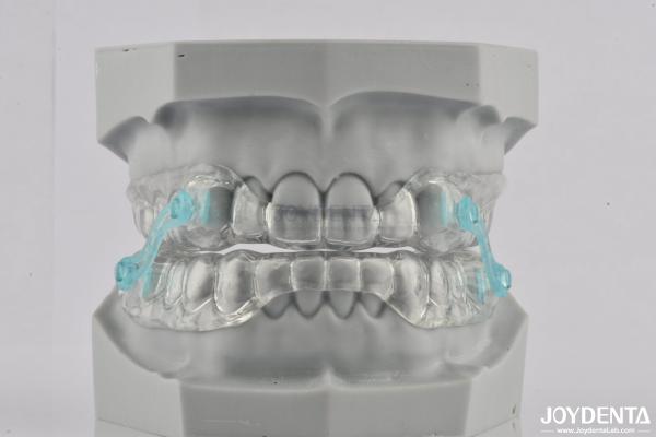 Custom Fitting Sleeping Aid Mouthpieces Dental Appliance To Stop Snoring