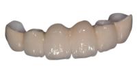 Couronne dentaire de porcelaine extérieure lisse reconstituer mâcher la bonne stabilité de puissance