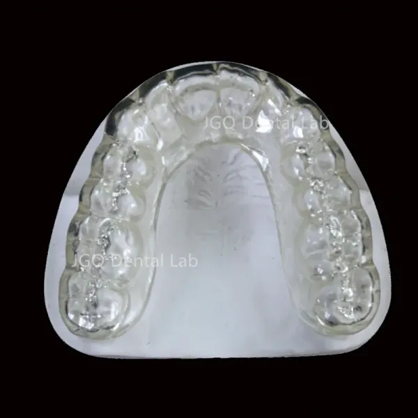 Dental Occlusal Splint Custom Made for Perfect Fit and Comfortable Night Guard Denture Lab China