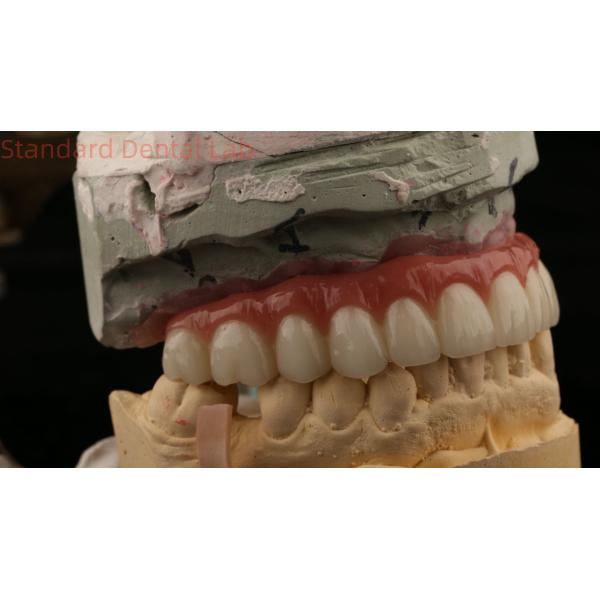 Hybrid Titanium Screw Retained Dental Implant Crown All On 4 Dental Implant Zirconia Bridge