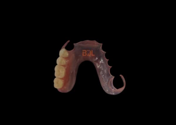 No Metal Showing Hypoallergenic Flexible Partial Denture with 3-Day Turnaround for Comfortable Dental Restoration