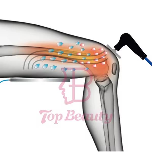 3 In 1 Tecar Diatermia Back Pain Relief 448k Indiba Radiofrecuency Ret Cet Rf Bracelet Vaginal Tightening Machine