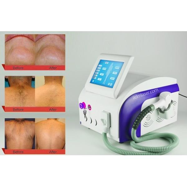 12*20mm 808nm 755nm 1064nm Laser Hair Removal Equipment