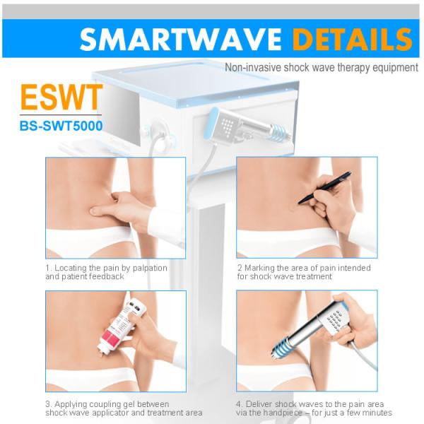 Patellar Tendonitis Treatment Shockwave Therapy Equipment With 8 Preset Protocols