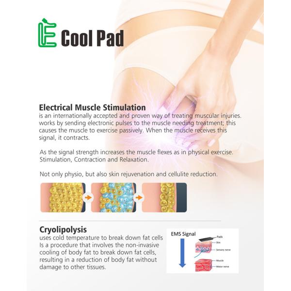 Машина 110V 60Hz Cryolipolysis дома экрана касания или высокая эффективность 220v 50Hz