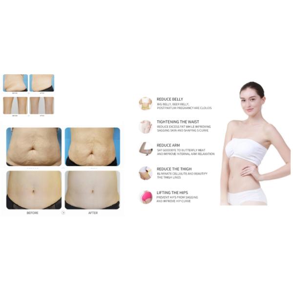 Домашняя потеря Крйолиполысис пользы 12В жирная уменьшая машину