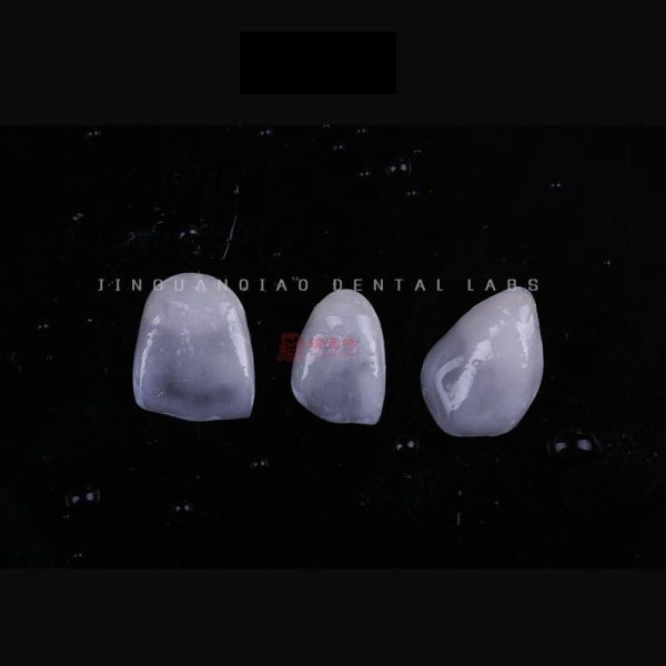 Tooth Like Shells Dental Porcelain Emax Veneers Dsd Design China Dental Lab