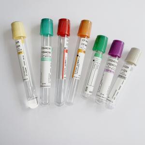 Testes bioquímicos da emergência não tóxica do tubo do citrato de sódio a