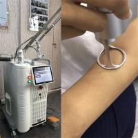 máquina del laser del CO2 635nm para el tratamiento grande 110V-250V de los poros de la piel