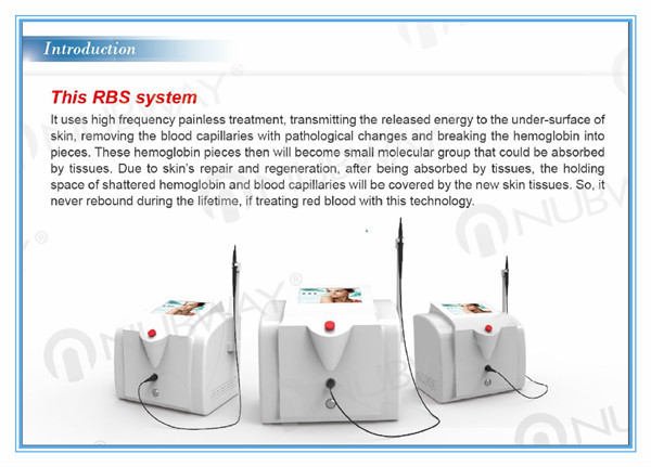 Painless safety high frequency 30MHZ spider vein removal and varicose vein treatment