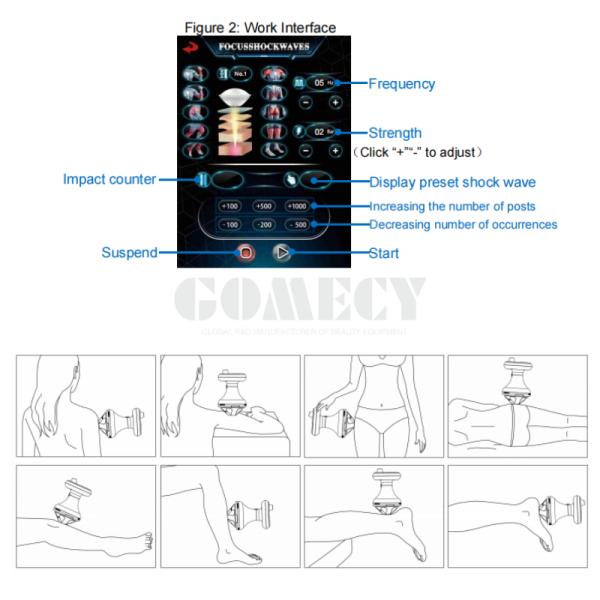 Focus Shockwave Therapy Machine Piezoelectric System for Deep Tissue Pain Relief and Rehabilitation Treatment