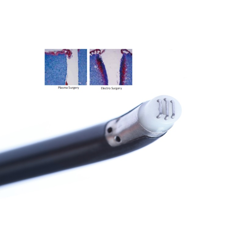 Low Temperature Bipolar Plasma Wand Tonsillectomy For Tonsillectomy
