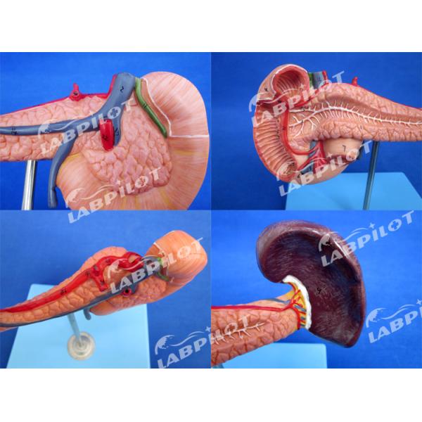 Educational Demonstration Model of Human Life Size Pancreas with Spleen and Duodenum