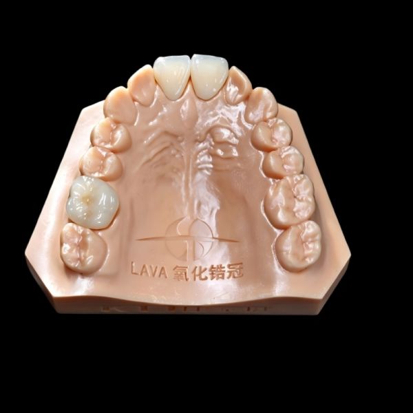 Lava Crown And Bridge High Accuracy