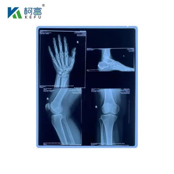 14x17 Inch X Ray Film / Medical X Ray Thermal Film Blue Film  For Medical Diagnosis