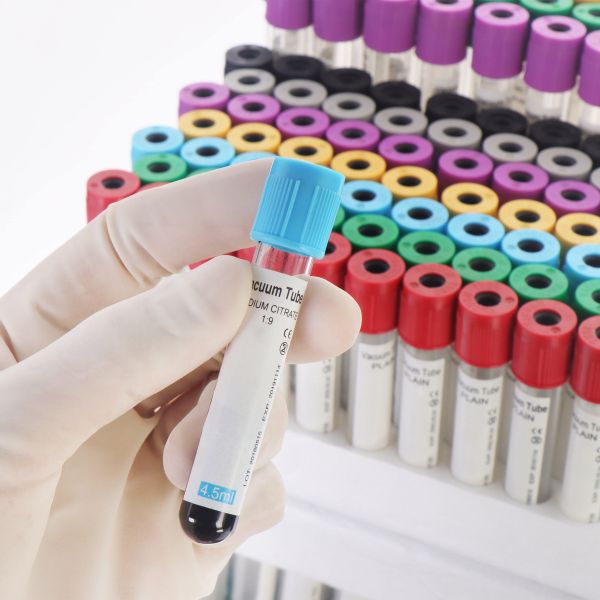 Vacuum EDTA Blood Tubes for Complete Blood Count (CBC) – High Quality, Secure Seal