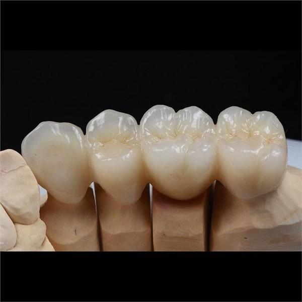 Biocompatible Zirconia Ceramic Dental Crown Tooth Restorations Custom