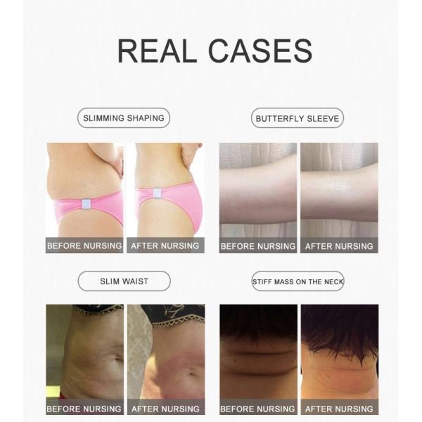 липозеро РФ вакуума кавитации ультразвука 40хз уменьшая машину МЛС05 красоты