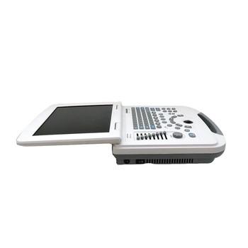 ON SALE!!!  Portable full digital laptop B&W ultrasound scanner for hospital