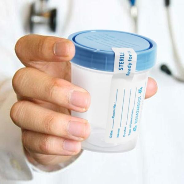 Disposable Specimen Cups| High-Grade Silicone, Sterile, Individually Wrapped Medical Cups W/Leakproof, Screw-On Lids