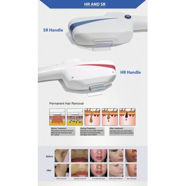 Vertical Dual Handle DPL Painless Salon Skin Treatment Beauty Equipment
