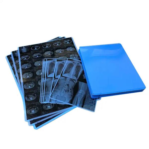 Medical Based Dry Imaging Xray Film For Making X-ray Film