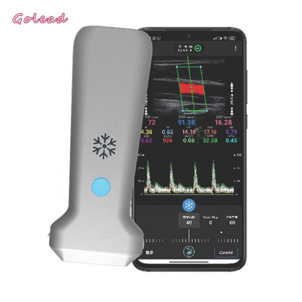 126mm Linear Probe Ultrasound Scanner For Vascular MSK Nerve