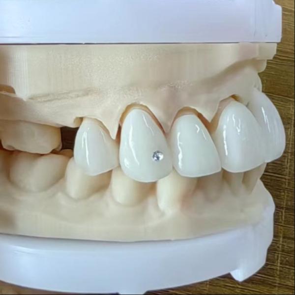 Esthétique naturelle pont de couronne en zirconium en couches pour un beau sourire et une bonne restauration