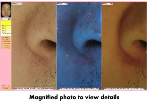 BS-3200 Analizadores Piel Canon Camera 3D Facial Skin Analyzer for Depth Area