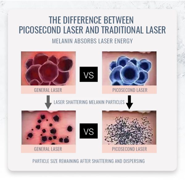 Portable picosecond laser Beauty Machine laser tattoo removal machine Laser mole removal Multifunctional laser machine