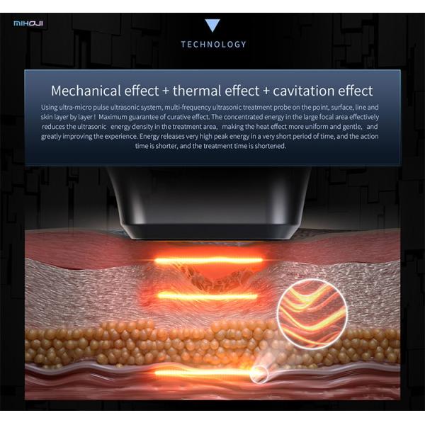 High Frequency Ultrasound Hifu Beauty Machine 2.0mm Cartridges For Face Lifting