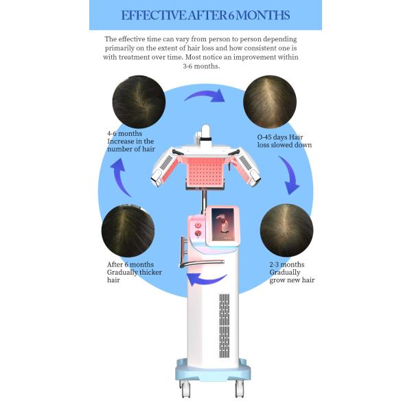 660nm Diode Laser Hair Growth Device For Hair Regeneration / Scalp Nourishment