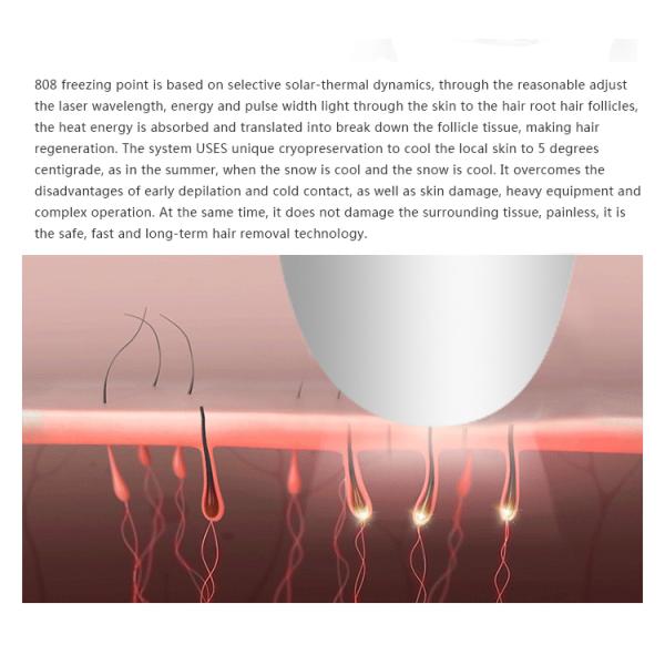 Pain Free 808nm Diode Laser Hair Removal Machine Non Channel Type For All Skins