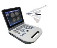Machine mobile de balayage d'OIN USG pour l'usage à la maison 3.5MHz R60 Wearproof
