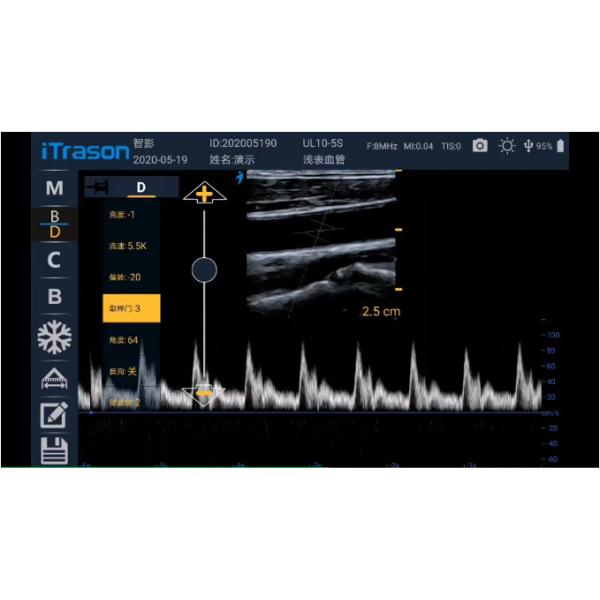 PICC 12MHz Hand Held Wifi Ultrasound Scanner 128 Element Probe